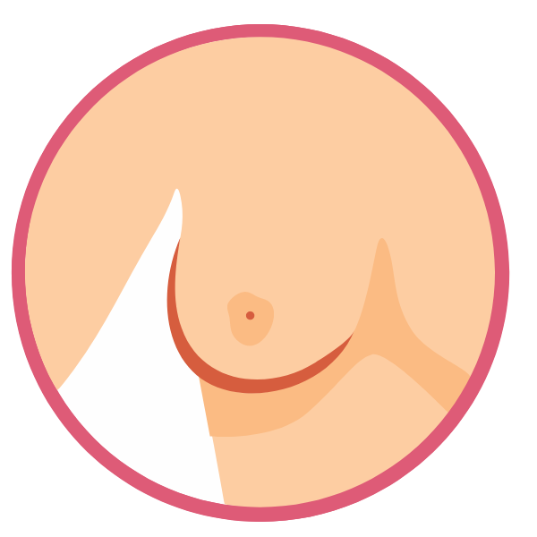 Nipple inversion