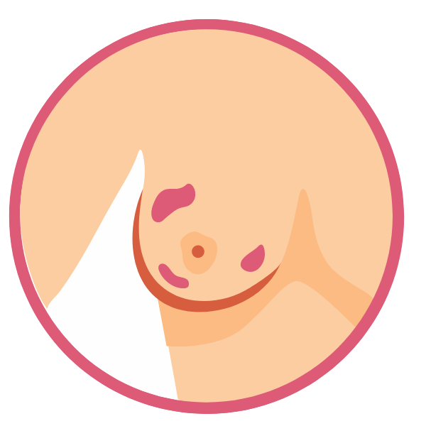 Skin redness